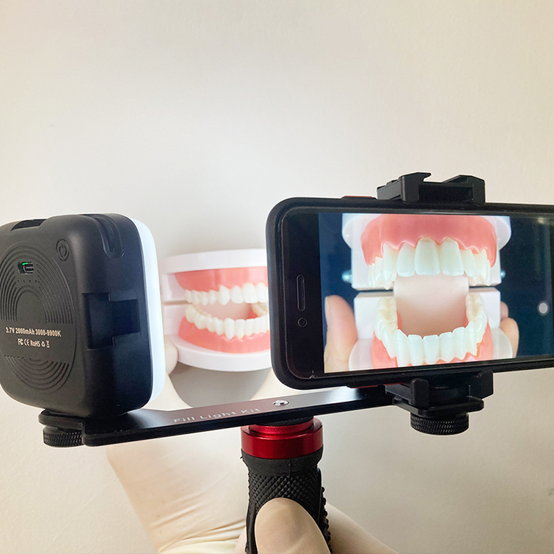 Dental Photography Clinic Light For Phone With Bluetooth Adjustable Colour Temperature - Image 2